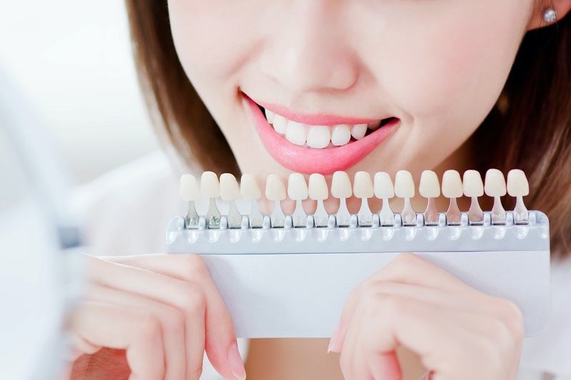 General Dentist’s Guide To Dental Bridges