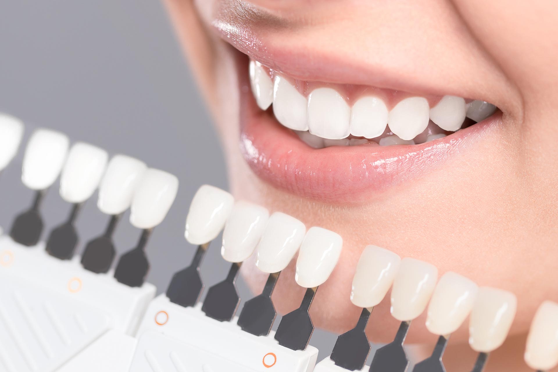 Restoring Confidence With Cosmetic Dentistry