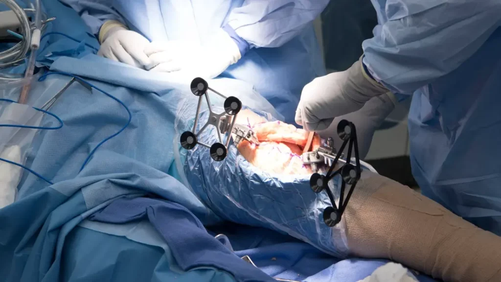 The Importance Of Orthopedic Research And Innovation
