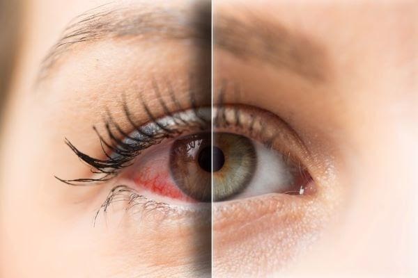 yellow eye contacts
