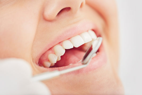 Oral Health