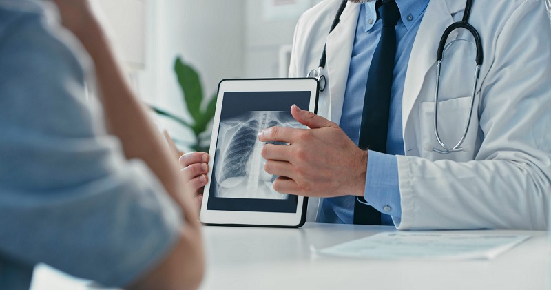 Innovative Treatment Approaches in Mesothelioma Remission Mesothelioma