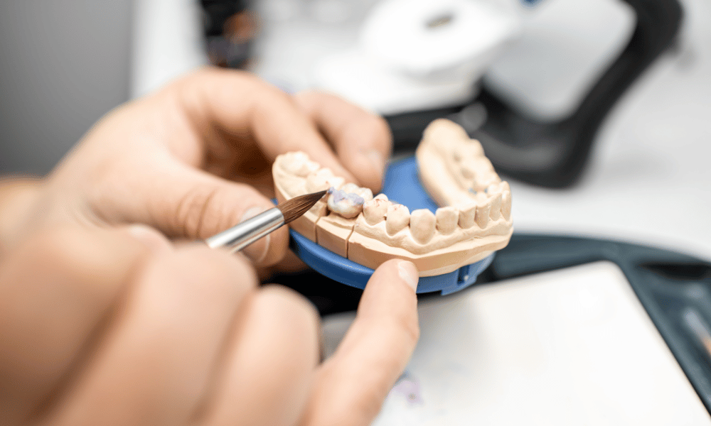 The Longevity of Dental Crowns: How Long Do They Last? dental crowns
