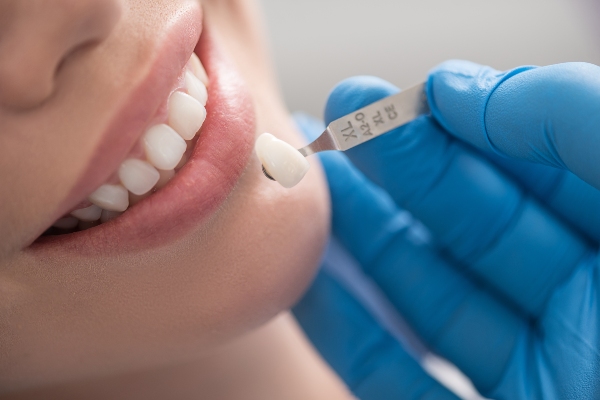 dental crowns