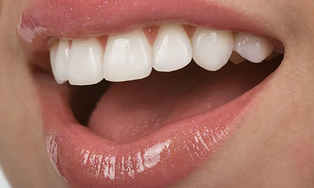 Transform Your Smile: Exploring the Top Cosmetic Dentistry Solutions dental imperfections