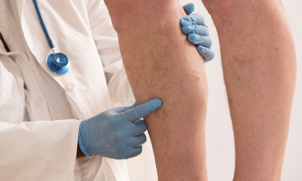 Cardiologists And Vascular Diseases: An Unseen Connection Vascular Diseases