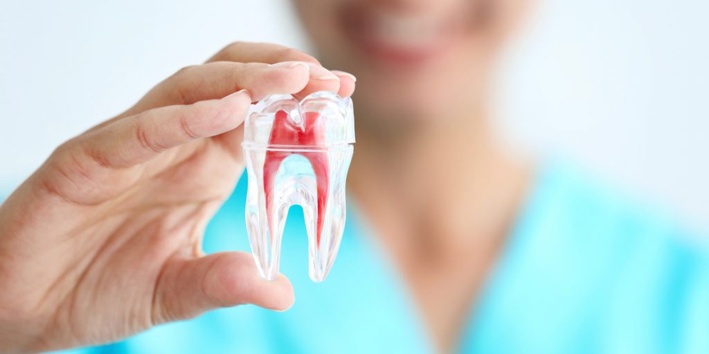 Dental Implants- Everything You Need to Know